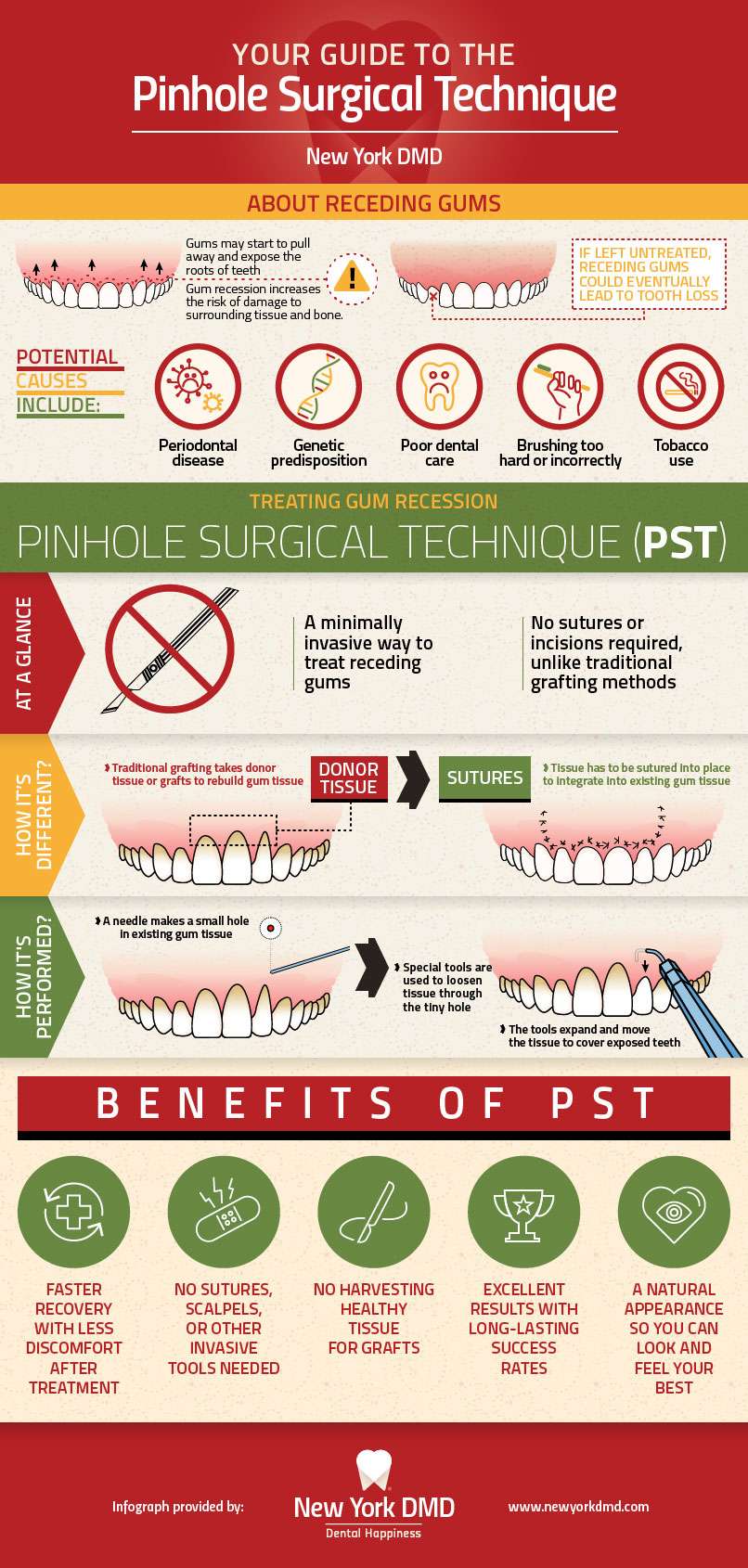 Infographic