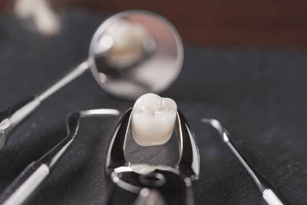 Dental Restoration Treatments For A Broken Tooth