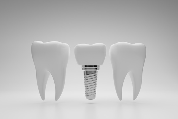 Proper Care For Dental Implants