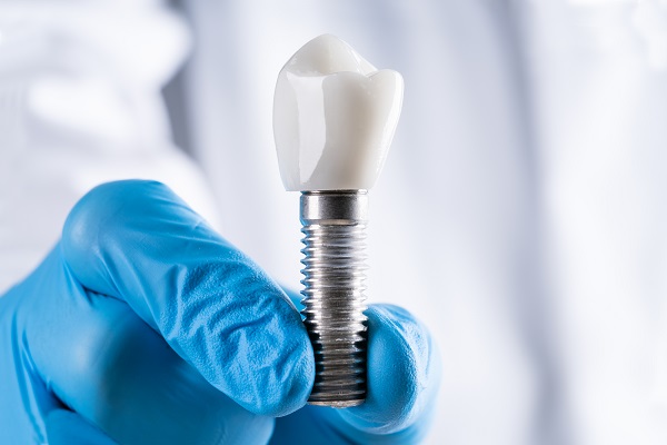 When Tooth Extraction With Dental Implants Is Recommended