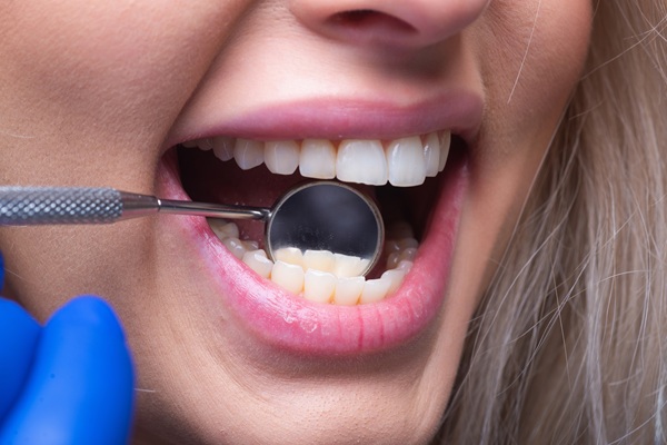 How Gum Disease Treatment Can Save Your Natural Teeth