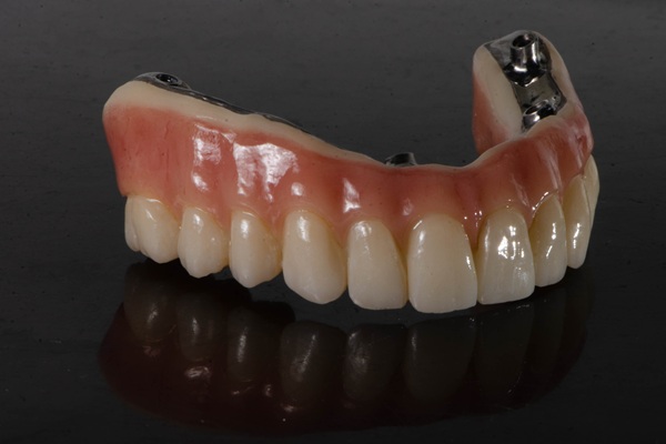 Why Choose Implant Supported Dentures? Top Benefits Explained