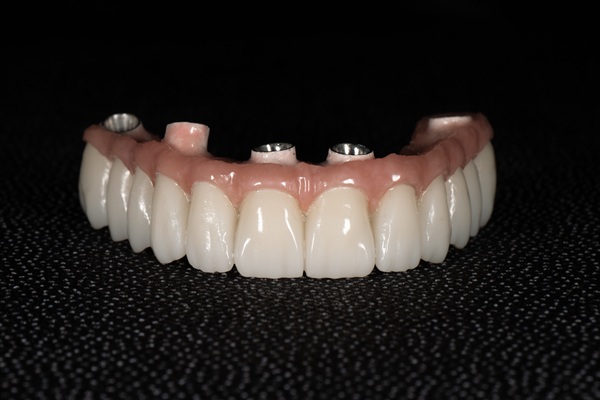 Can You Eat Normally With Implant Supported Dentures?