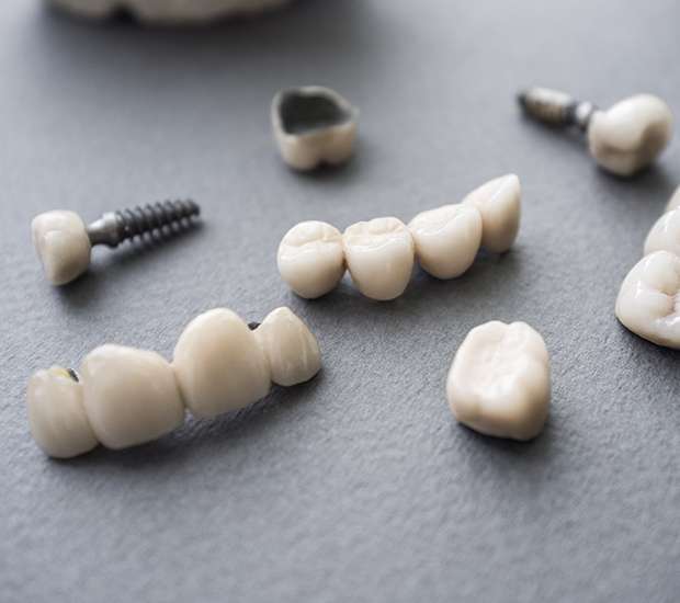 New York The Difference Between Dental Implants and Mini Dental Implants