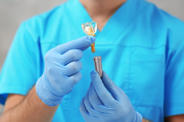 FAQs Of Mini Dental Implants