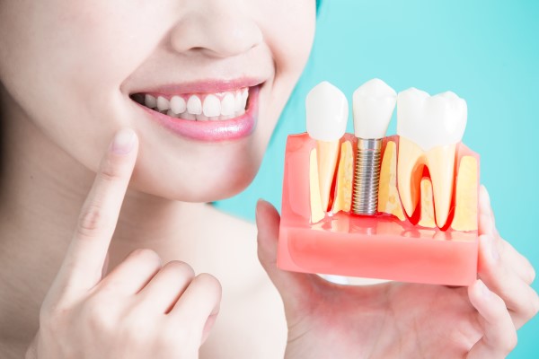 What Is The Process Of Replacing A Missing Tooth?