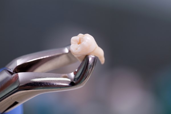 Oral Surgery For Wisdom Tooth Extraction From A General Dentist